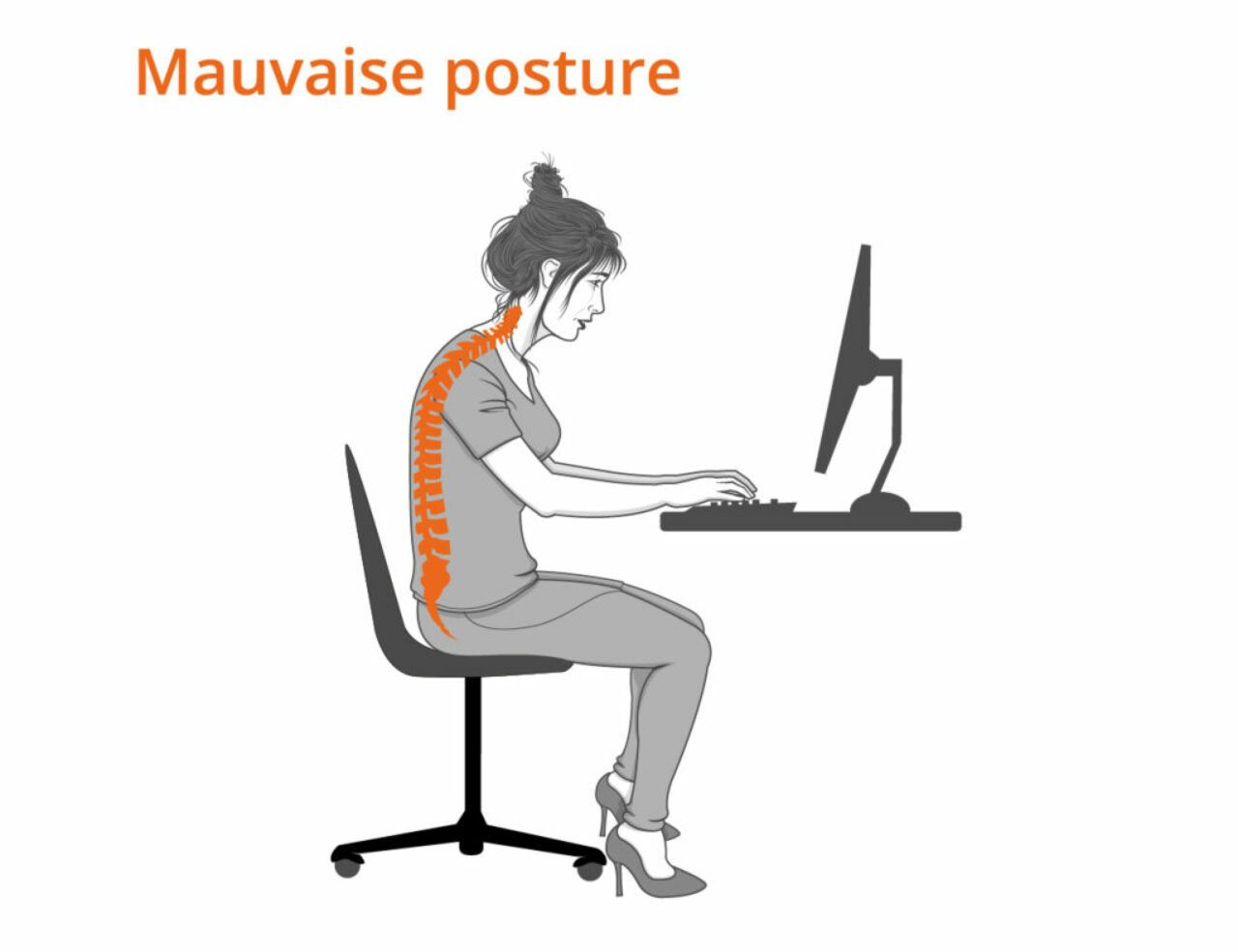 Illustration of poor sitting posture, which distorts the spine and exacerbates back pain